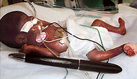 images of babies born at 35 weeks. orn in Miami”